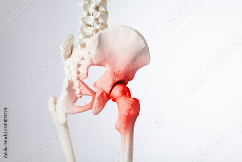 Hip bone pain, human skeleton hip arthritis 