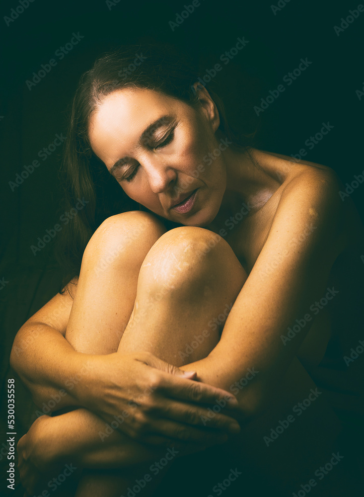 Naklejka premium with my marks and scars VI