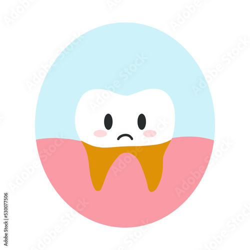 Tooth root caries in cartoon flat style. Vector illustration of disgruntled unhealthy teeth character, dental care concept, oral hygiene