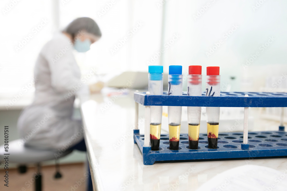 Blood transfusion station.Nurse with blood tests.Blood in test tubes. Blood transfusion station.Nurse with blood tests.Blood in test tubes.