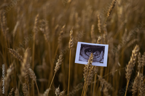 ultrasound image of a baby 