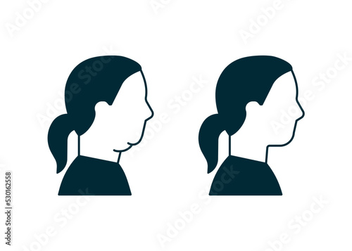 Double chin of woman icon, change in facial aesthetics. Fat loss in overweight on face. Profile girl before and after liposuction, lifting, plastic procedure. Vector illustration