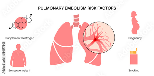 Pulmonary embolism disease