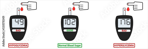 A concept for measuring blood glucose levels. Low blood glucose, normal blood glucose, high blood glucose on the glucose meter display. Hyperglycemia, hypoglycemia, normoglycemia.