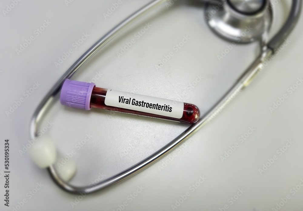Blood sample for Viral gastroenteritis(Stomach Flu) test to diagnosis