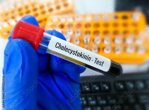 Cholecystokinin is a gastrointestinal peptide hormone which is responsible for the stimulating of the digestion of fat and protein. photo