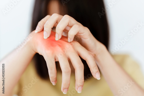 woman itching on hand Due to allergy to certain substances or skin disease.