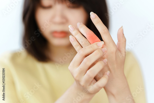 Close-up of a woman s hand with joint pain causing rheumatoid arthritis. Health care concept.
