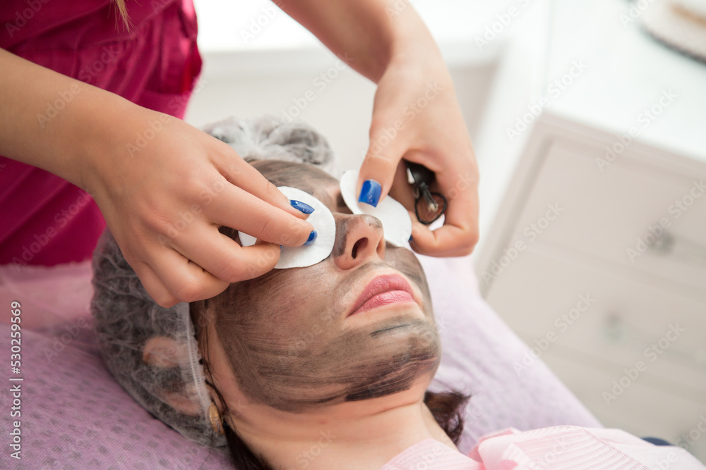 A woman wears protective glasses over cotton pads over her eyes during the carbon peeling procedure. A woman wears protective glasses over cotton pads over her eyes during the carbon peeling procedure.