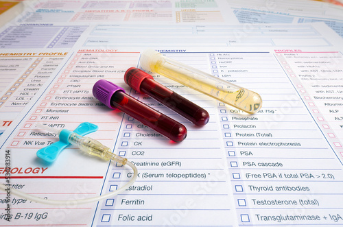 blood sample and urine collection tubes and supplies with requisition form for analysis in the clinical laboratory. Blood tubes and urine of patient with test report for analysis in the Hematology lab