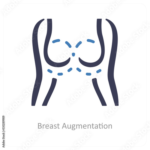 Breast augmentation
