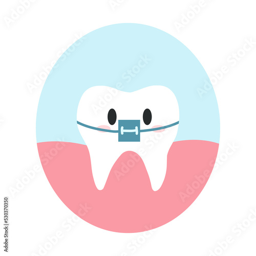 Cute healthy tooth with braces in cartoon flat style. Vector illustration of healthy teeth character, orthodontic fixed structures, dental care concept, oral hygiene