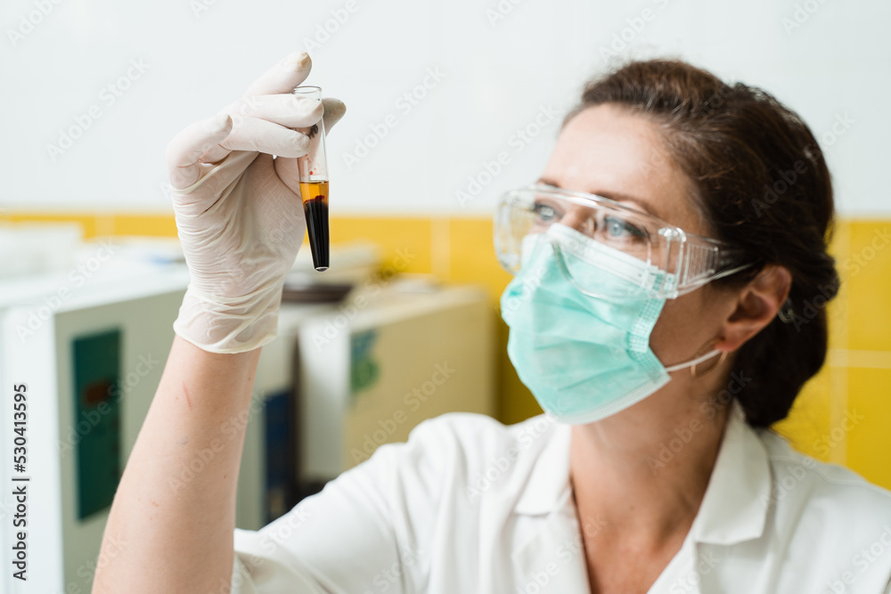 Analysis of blood plasma. The laboratory assistant holds a test tube with blood from a vein in his hands and looks at it. Blood test in the laboratory. Medical scientist with glasses and mask. Analysis of blood plasma. The laboratory assistant holds a test tube with blood from a vein in his hands and looks at it. Blood test in the laboratory. Medical scientist with glasses and mask.
