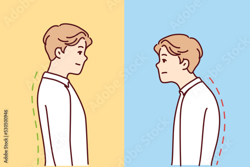 Comparison of man with good and bad back posture. Male suffer from scolisosis from sedentary work. Vector illustration. 