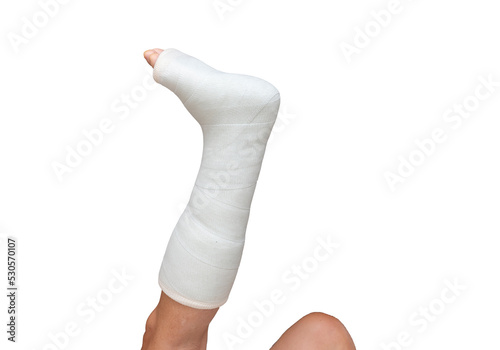 Woman with her broken leg. leg in a cast on isolated white background. Close up