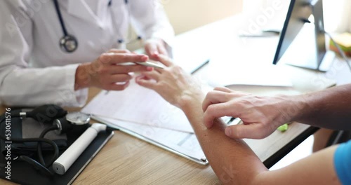 Professional doctor looking at painful dermatological infection on patient hand