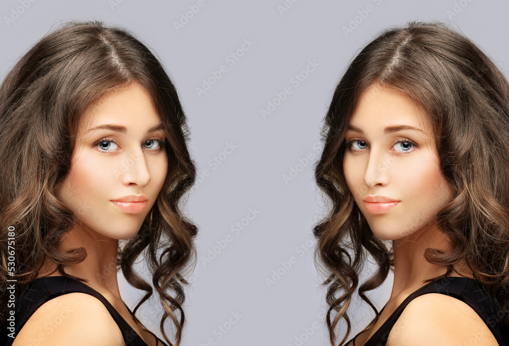 Rhinoplasty.Before and after. process of reconstructing nose Rhinoplasty.Before and after. process of reconstructing nose