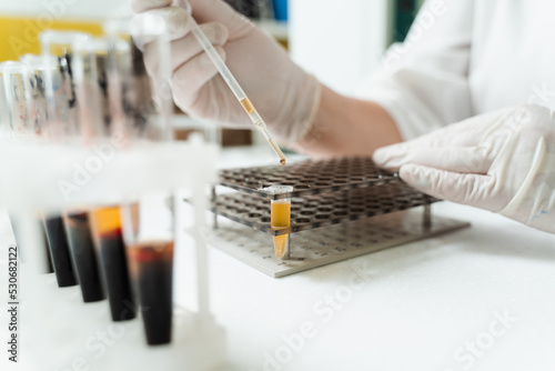 Analysis of blood plasma close-up. Laboratory assistant hold test tube with blood from vein in his hands and looks at it. Blood test in the laboratory. photo