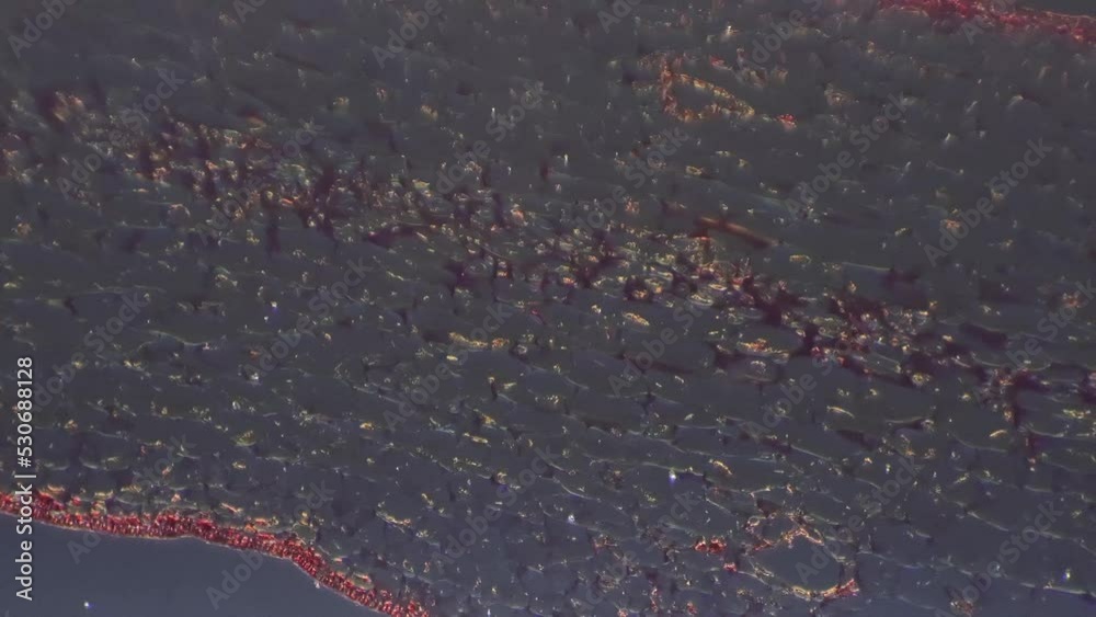 Longitudinal section of Polliondium of Funaria magnified by microscope ...