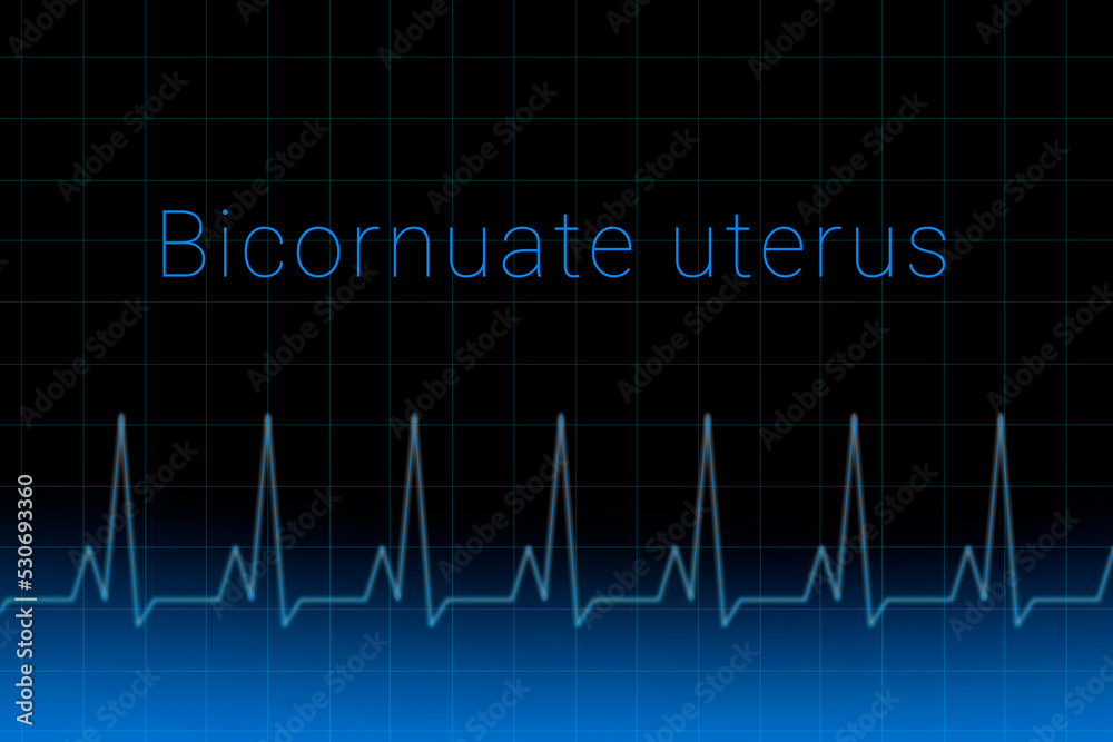 Bicornuate uterus disease. Bicornuate uterus logo on a dark background. Heartbeat line as a symbol of human disease. Concept Medication for disease Bicornuate uterus. Bicornuate uterus disease. Bicornuate uterus logo on a dark background. Heartbeat line as a symbol of human disease. Concept Medication for disease Bicornuate uterus.