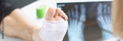 Traumatologist holds MRI scan of feet of male leg closeup