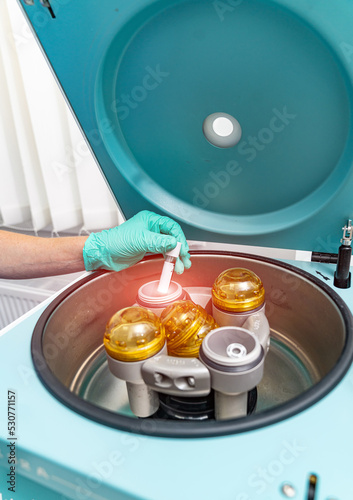 Professional medical biotechnology instrument. Plateletrich plasma laboratory syringe centrifuge. photo