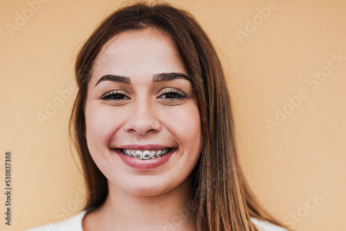 Beautiful teenage girl with dental braces smiling on camera