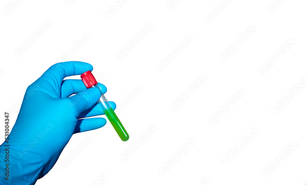 Hand with latex surgical glove holds sealed test tube with green liquid on white background. medical advertising concept Hand with latex surgical glove holds sealed test tube with green liquid on white background. medical advertising concept
