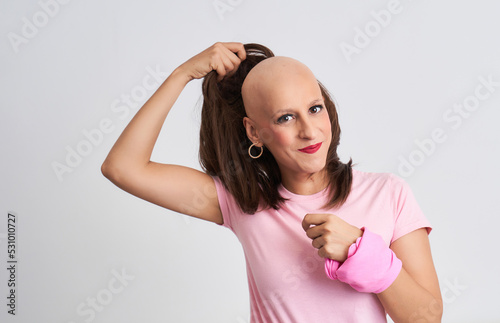 Woman with cancer taking off her wig showing her hairless head