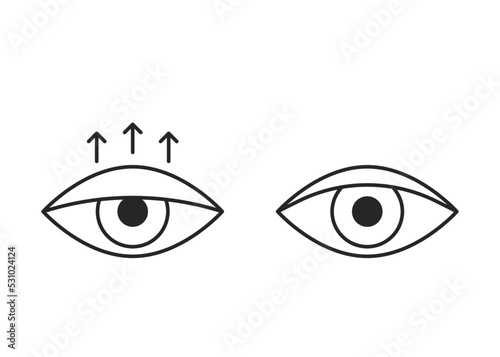 Comparison eye with down lid ptosis and healthy eyelid, line icon. Blepharoplasty, eyelid surgery. Correction aesthetic view of eye. Vector illustration photo