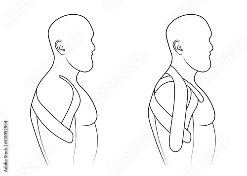 Kinesiology therapeutic sports tape on shoulder sketch vector illustration.