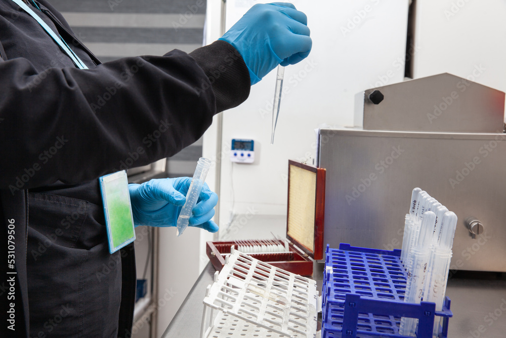 Female scientist preparing slides for karyotipe and fluorescence in