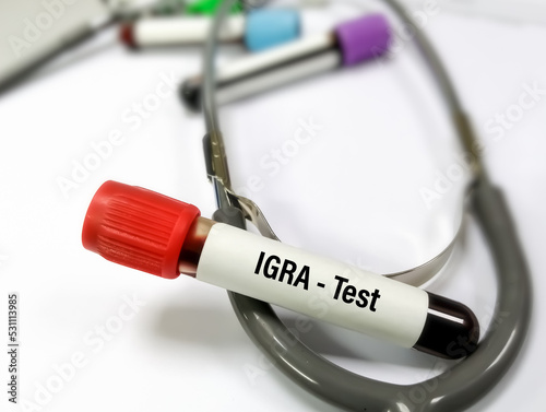 Blood sample for IGRA(interferon gamma release assay) test for diagnosis of Tuberculosis photo