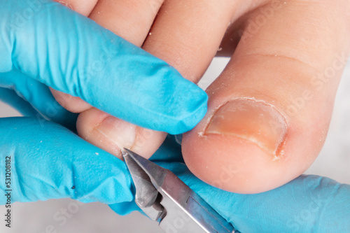 A chiropodist gives a pedicure to the client's feet, cutting dry skin with clippers. Close up. The concept of foot care and chiropody photo