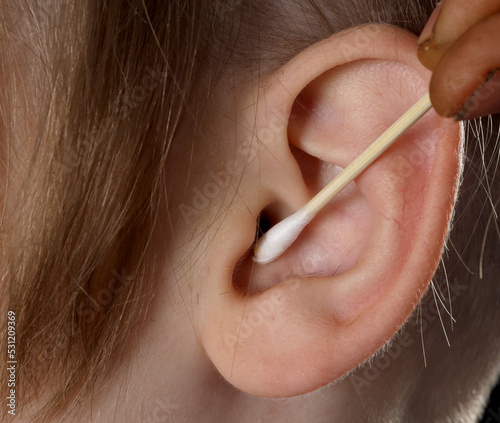 cleaning the ear using a stick with a cotton swab © makarsl