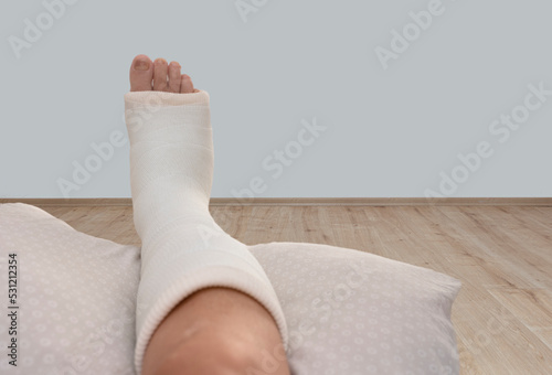 ankle and foot splint Bandages on the legs. Foot surgery, Wrapped feet with plaster or pressure bandage after operation photo