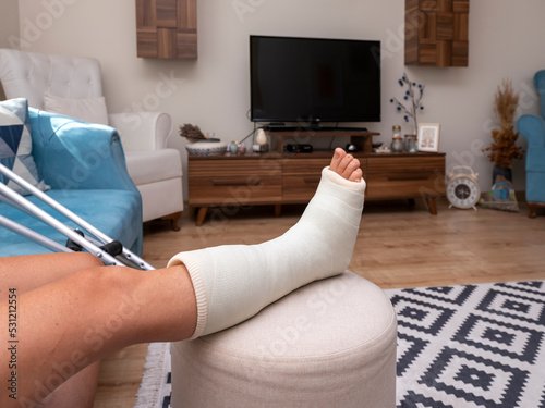 broken ankle and a leg cast. Leg splint