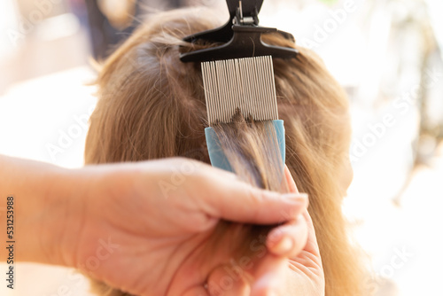 head lice head treatment,stock photography photo
