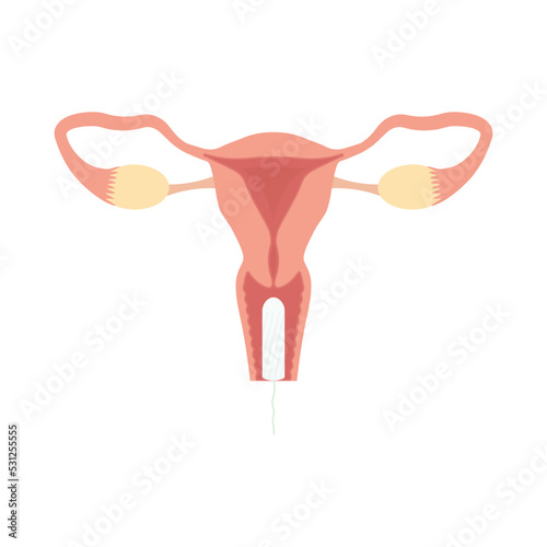 Illustration of  tampon for periods using.