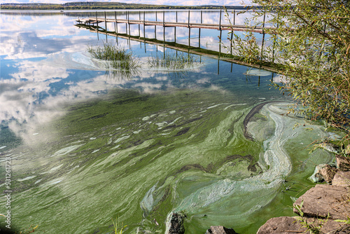 Phytoplankton population explosions cause algae blooms, lake pollution. photo