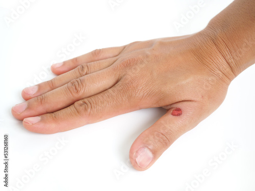 Female fingers are wounded. Health concept. Closeup photo, blurred.