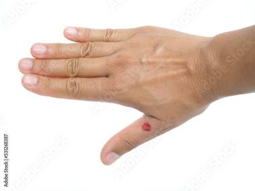 Female fingers are wounded. Health concept. Closeup photo, blurred.