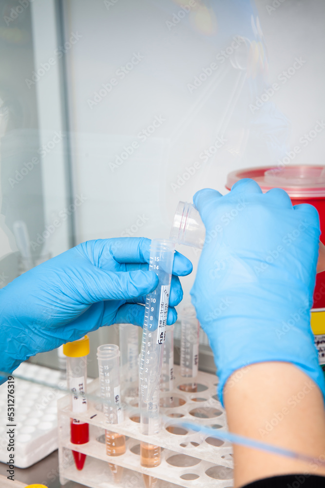 Scientist preparing blood samples for karyotipe and fluorescence in