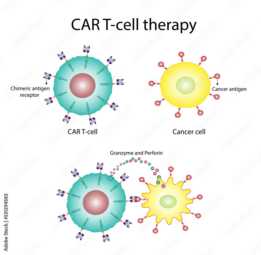 Car t cell therapy and cancer treatment cancer therapy car t cells