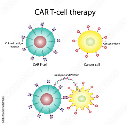 CAR T-cell therapy and Cancer treatment . Cancer therapy. CAR T cells immunotherapy.  Chimeric antigen receptor T cells. T cell receptor proteins that have been engineered to kill cancer cells. Vector
