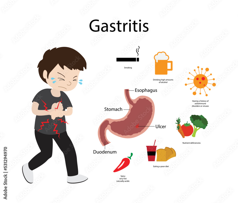 illustration of biology and medical, Gastritis is a condition that