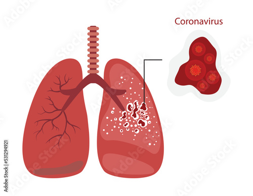 illustration of biology and medical, The coronavirus is an infection that destroys the lungs of human, Coronavirus destroys lungs, causing heart inflammation, lungs of a patient 
