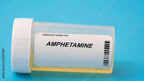 Amphetamine. Amphetamine toxicology screen urine tests for doping and drugs photo
