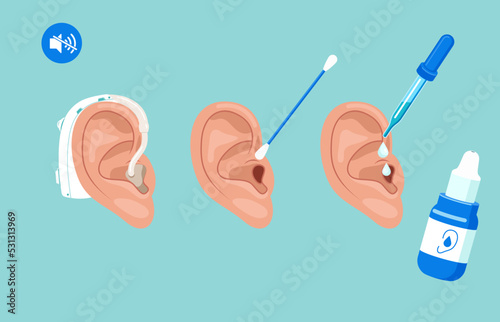 Personal hygiene routine and care. Removing cerumen, otitis treatment with serum medical drops Human ears with aerophone, cotton swab and pipette. Vector illustration.