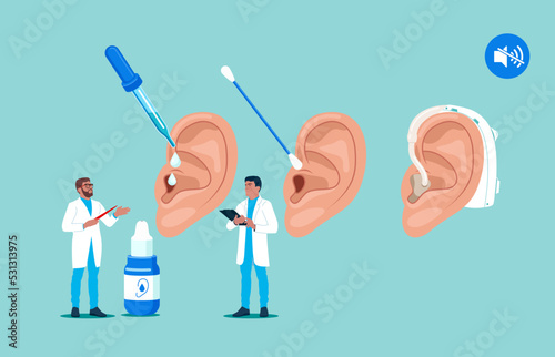 Personal hygiene routine and care. Removing cerumen, otitis treatment with serum medical drops Human ears with aerophone, cotton swab and pipette. Vector illustration. photo